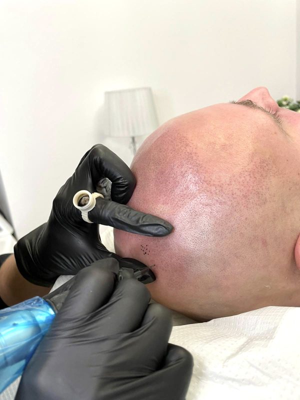 mikropigmentacja